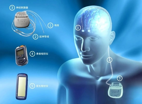 基于视觉的帕金森辅助医疗诊断系统